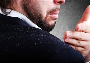 تعاني من قشرة الرأس؟.. احذر هذا المرض 