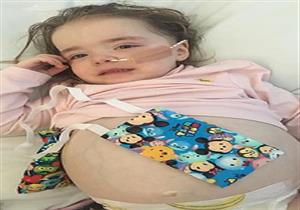 مرض نادر يصيب طفلة بإنجلترا ويجعلها حاملًا.. كيف حدث ذلك؟