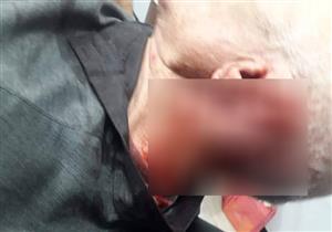 "مش هفرط في أرضي".. جملة تسببت في قطع أذن فلاح وبتر أصبع ابنه