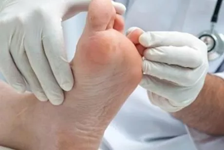 هل عين السمكة من الأمراض المعدية؟- إليك حقيقة هذا الأمر
