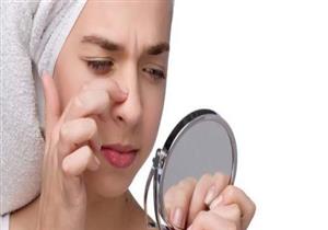 لماذا تهاجم الرؤوس السوداء بشرتك؟ 