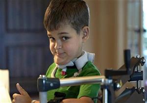 أعراضه تشبه الإنفلونزا.. مرض غامض يصيب الأطفال ويهددهم بالشلل