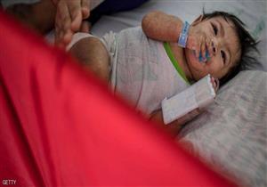 عشرات الإصابات الجديدة بالحصبة في 26 ولاية أمريكية