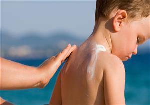 كيف تتعامل مع الحروق الشمسية للأطفال؟ 