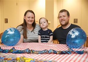 "الطفل المعجزة..  لامبارد ولد برئة وكلية واحدة وقلب في جانبه الأيمن" صور