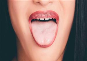  لون لسانك يكشف حالتك الصحية.. إليك الدليل