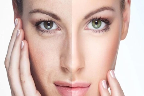 الكولاجين أم البيوتين.. أيهما أفضل لصحة الشعر والبشرة؟