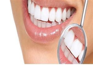 مزايا ومحاذير.. كل ما تريد معرفته عن تبييض الأسنان