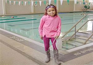 شفاط الحمام أخرج أمعائها.. "سلمى" لم تتناول الطعام منذ 10 سنوات