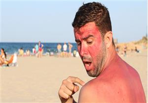 ما هي الإسعافات الأولية عند التعرض لحروق الشمس؟