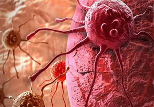 اكتشاف فيروس زكام يعالج سرطان المثانة