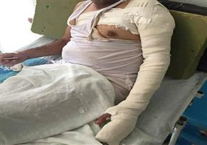  أشعلا فيه النيران.. سائق يعتدي على عامل بسبب "دابة" بالزقازيق