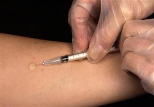 نتائج أولية واعدة للقاح جديد يستهدف السل 