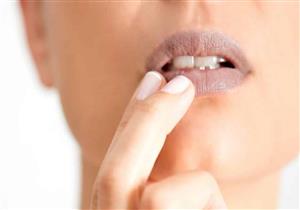 فمك يكشف إصابتك بالأنيميا.. إليك أعراض نقص الحديد على اللسان واللثة