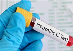 لا تنتقل بالقبلات.. 7 نصائح للتعامل مع المصابين بالفيروسات الكبدية