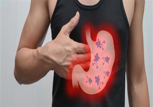 لمرضى جرثومة المعدة.. إليكم قائمة بالأطعمة الممنوعة