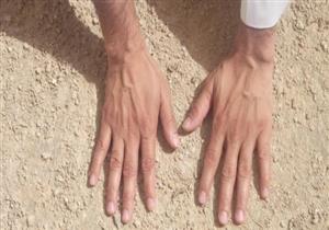 كيف يكون الوضوء والغسل من الجنابة في حالة المرض؟.. أمين الفتوى يوضح