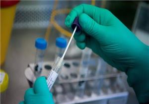 نائبة لوزير التعليم العالي: أطباء المستشفيات الجامعية لم يلتزموا ببروتوكول علاج كورونا 