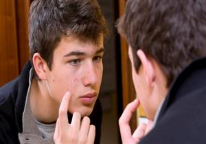 تعاني من حب الشباب؟.. 5 مشروبات صحية للتخلص منه (صور)