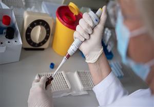 لماذا يعجز بعض متعافي كورونا عن إنتاج أجسام مضادة؟