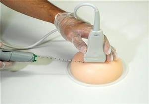 فعالة في تشخيص السرطان.. كل ما تريدين معرفته عن خزعة الثدي