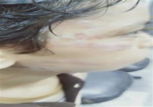 أم تقتحم مدرسة وتصيب زميل ابنها بارتجاج في المخ بالقليوبية 