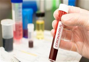 الحالة السادسة.. وفاة مديرة مدرسة في البحيرة بفيروس كورونا