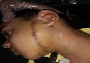 سخر منه.. قرار جديد بشأن "صبي حلاق" متهم بالشروع في قتل طفل بالشرقية