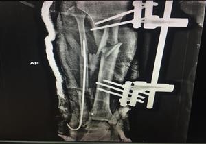 بالصور.. إنقاذ مصاب في حادث بجنوب سيناء من بتر ساقه