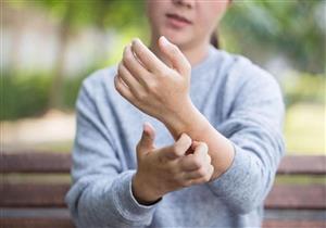  ما هي أسباب وأعراض الصدفية؟ 