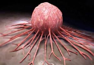 غير جرثومة المعدة.. 4 فيروسات مصدر الإصابة بالأورام الخبيثة