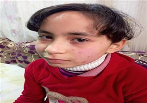 طالب جامعي يتهم مدرسة بالاعتداء على شقيقته وتشويه وجهها في كفرالشيخ