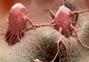 الصحة العالمية: زيادة نسبة الإصابة بالسرطان 81% في البلدان الفقيرة