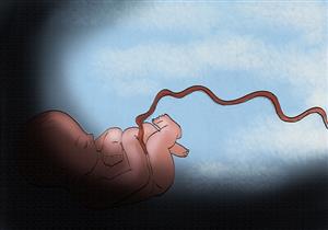 خلايا الحبل السري تنقذ طفلة داليا.. وتؤَمَن حياة عائلة وليد