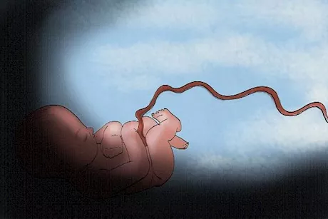 تأخير قطع الحبل السري.. لماذا يُنصح بالانتظار بعد الولادة؟