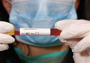  رفض الذهاب لمطروح.. 8 معلومات عن الألماني أول حالة وفاة بـ"كورونا" في مصر  