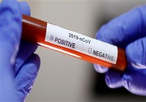 طبيب فيروسات كبدية عن رسالة السيسي للمصريين: تحذير لـ"ضعاف النفوس"