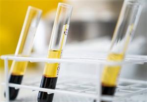 أستاذ علم الأوبئة: نتائج مبشرة لعلاج كورونا ببلازما المتعافين