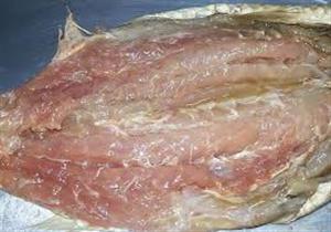 مصل الممباري.. خطوات الحصول على علاج تسمم الفسيخ 