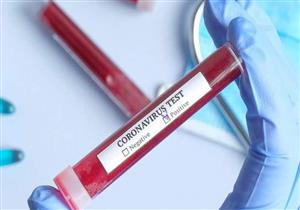 تعافي 21 حالة من "كورونا" في مستشفى كفر الدوار بالبحيرة