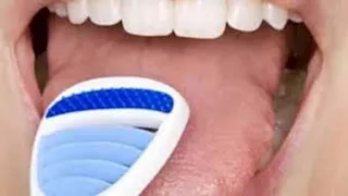 لسانك قد يكشف أسرار صحتك.. ما دور الذكاء الاصطناعي؟