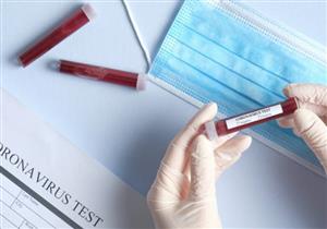 ارتفاع عدد الإصابات بكورونا في النمسا إلى 12 ألفًا و238 حالة 