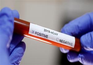 ألمانيا: تسجيل أكثر من 11 مليون اختبار للكشف عن كورونا