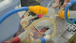 "معلومات الوزراء" يكشف تفاصيل أول جهاز تنفس صناعي مصري