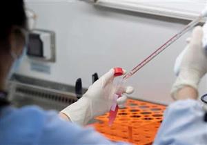 علماء يكتشوف 28 فيروسا غير معروفة في التبت