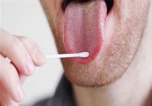 مضاعفاتها خطيرة.. طرق علاج المشكلات الصحية المسببة لاحمرار اللسان