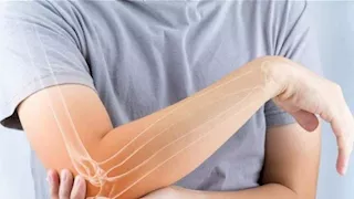 كيف تؤثر حقن إنقاص الوزن على العظام؟.. احذر المخاطر