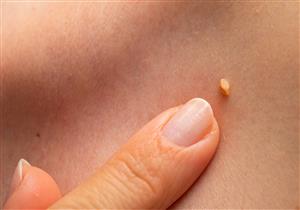 علامات إذا ظهرت بجسمك عليك زيارة الطبيب فورًا