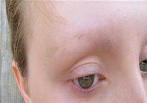 9 تغيرات خطيرة بالجسم قد تحدث دون أن تدري.. تحتاج إلى طبيب