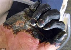 هل الطاعون الدملي بالصين خطر على البشرية؟.. "الصحة العالمية" تجيب